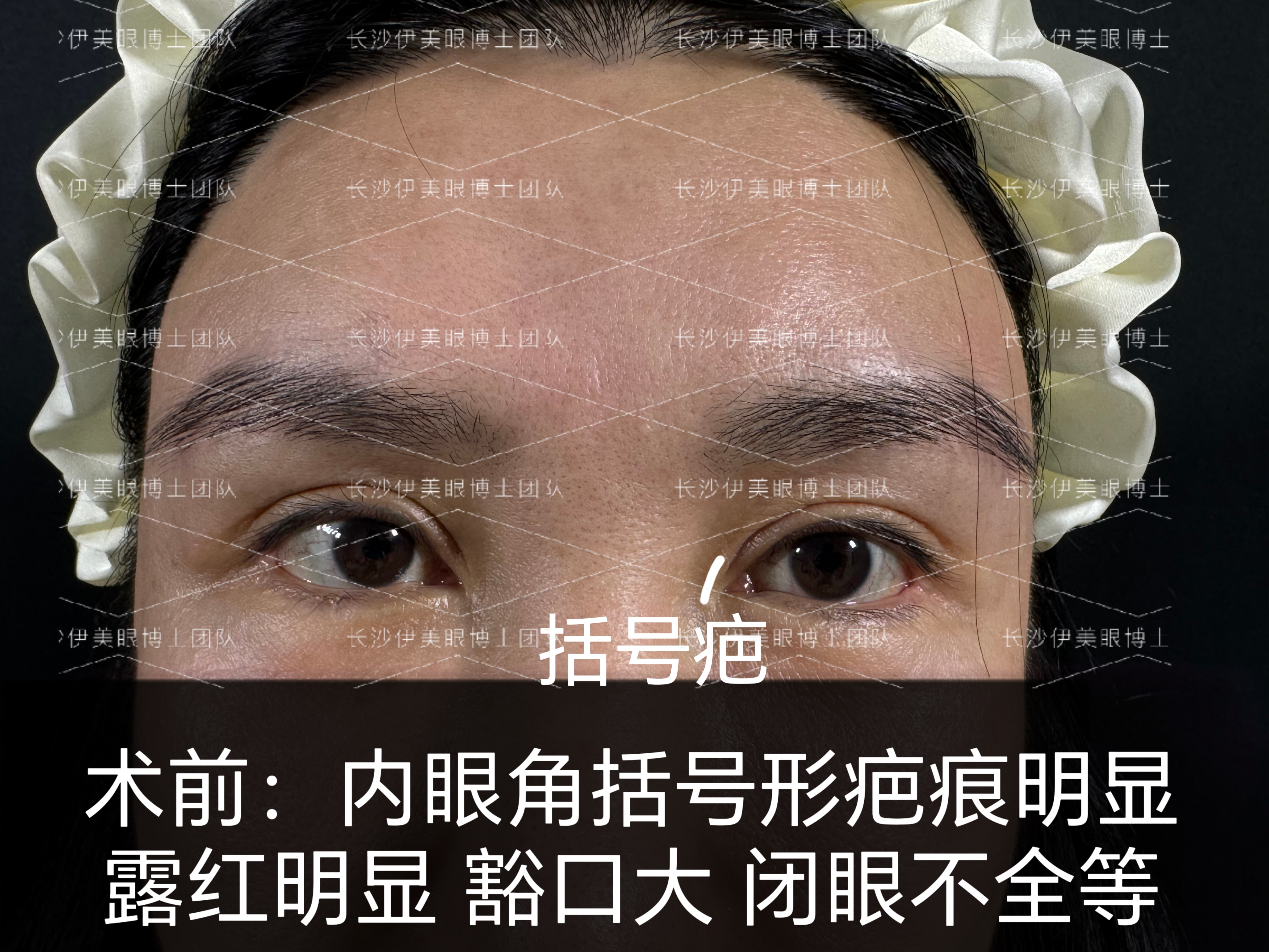 关于浓眉赛季中遭遇视网膜脱落目前已接受修复手术的信息  第1张